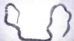 Parazit cucerumber retiazka: symptómy a liečba